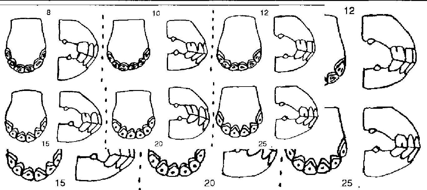 dientes13yopng-1.jpg