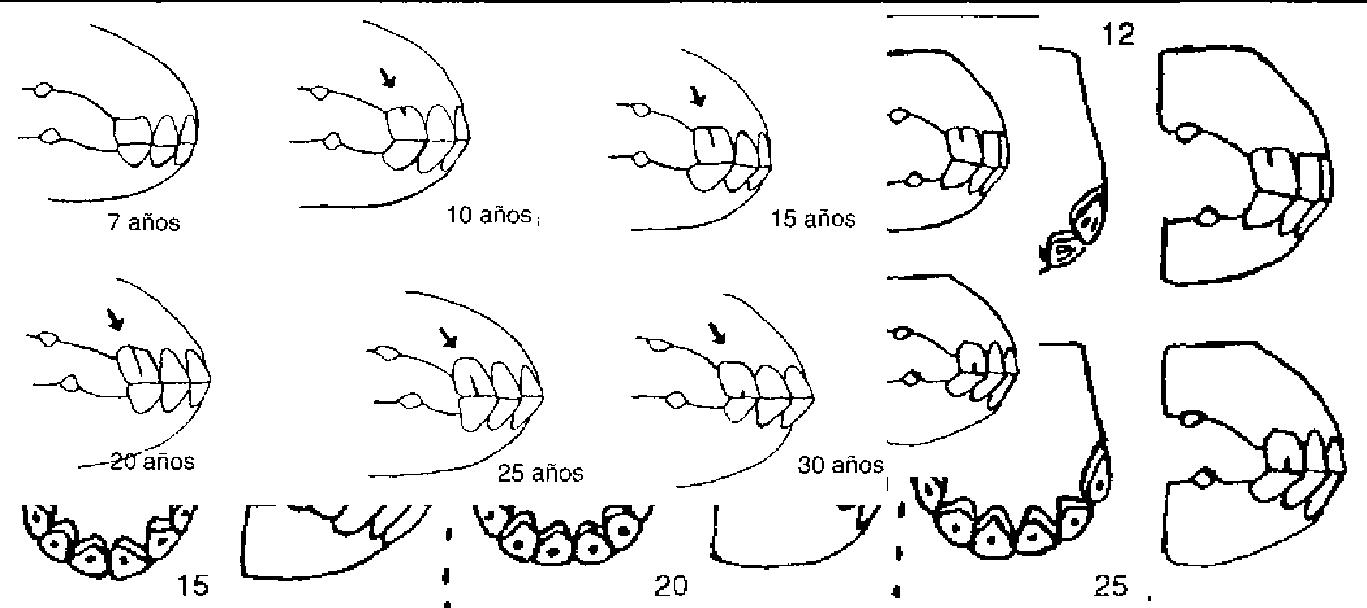 dientes37wbpng-1.jpg