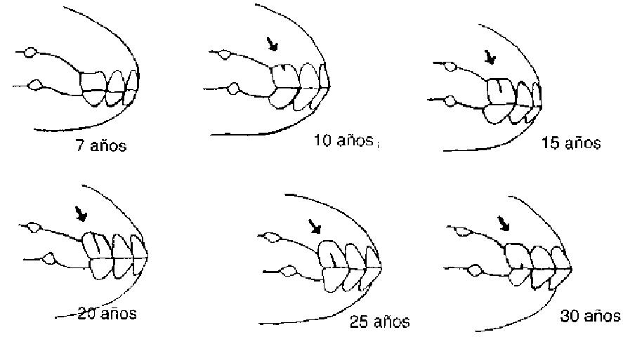 dientes50gcpng-1.jpg