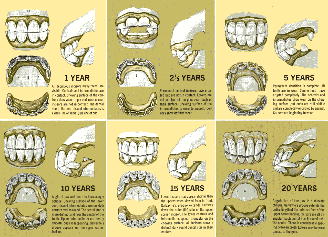 dientes2.gif