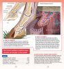laminitis-founder.jpg